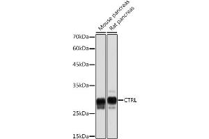 Western blot analysis of extracts of various cell lines, using CTRL Rabbit mAb (ABIN7266395) at 1:5000 dilution. (Chymotrypsin Antikörper)