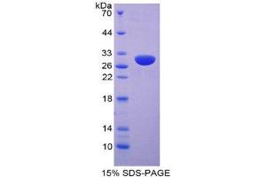 SDS-PAGE (SDS) image for Hexosaminidase A (HEXA) (AA 318-529) protein (His tag) (ABIN2125192)