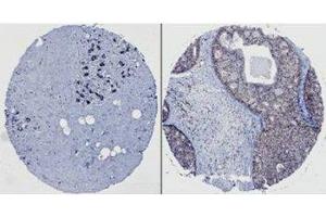 Image no. 3 for anti-Neural Precursor Cell Expressed, Developmentally Down-Regulated 9 (NEDD9) (AA 82-398) antibody (ABIN7278755) (NEDD9 Antikörper  (AA 82-398))