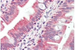 Human Small Intestine (formalin-fixed, paraffin-embedded) stained with BAK1 antibody ABIN461962 at 20 ug/ml followed by biotinylated goat anti-rabbit IgG secondary antibody ABIN481713, alkaline phosphatase-streptavidin and chromogen.