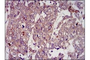 Immunohistochemistry (IHC) image for anti-Insulin-Like Growth Factor 2 (IGF2) (AA 25-180) antibody (ABIN1846026) (IGF2 Antikörper  (AA 25-180))