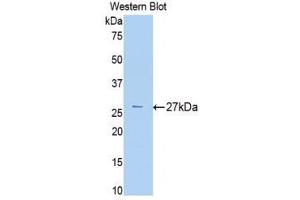 Western Blotting (WB) image for anti-alpha-2-Macroglobulin (A2M) (AA 216-437) antibody (ABIN1077782) (alpha 2 Macroglobulin Antikörper  (AA 216-437))