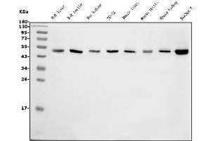 Western blot analysis of eRF1/ETF1 using anti-eRF1/ETF1 antibody (ABIN7602626). (ETF1 Antikörper  (AA 9-342))