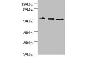 Western blot All lanes: RMDN3 antibody at 4 μg/mL Lane 1: Hela whole cell lysate Lane 2: MCF-7 whole cell lysate Lane 3: Mouse liver tissue Secondary Goat polyclonal to rabbit IgG at 1/10000 dilution Predicted band size: 53, 39 kDa Observed band size: 53 kDa (RMDN3 Antikörper  (AA 171-470))