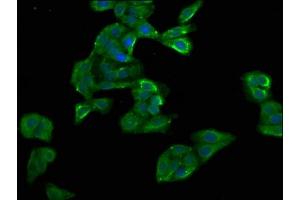 Immunofluorescence staining of HepG2 cells with ABIN7154468 at 1:100, counter-stained with DAPI. (GADD45B Antikörper  (AA 1-160))