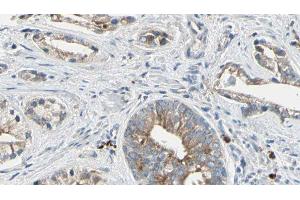 ABIN6278142 at 1/100 staining Human prostate tissue by IHC-P. (PTP4A2 Antikörper  (Internal Region))