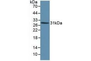 Detection of Recombinant KLK1, Human using Polyclonal Antibody to Kallikrein 1 (KLK1) (Kallikrein 1 Antikörper  (AA 25-261))