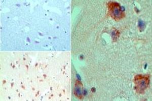 Image no. 1 for anti-Histone Deacetylase 9 (HDAC9) (AA 100-150) antibody (ABIN960197) (HDAC9 Antikörper  (AA 100-150))