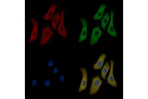 Annexin A2 Mouse Monoclonal Antibody staining Hela cells by IF/ICC. (Annexin A2 Antikörper  (Internal Region))