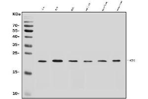 Western blot analysis of ARF6 using anti-ARF6 antibody (ABIN7602413).