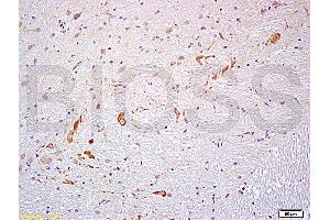 Formalin-fixed and paraffin embedded rat brain labeled with Anti- PROK2/Prokineticin 2 Polyclonal Antibody, Unconjugated (ABIN714701) at 1:200 followed by conjugation to the secondary antibody and DAB staining (PROK2 Antikörper  (AA 28-100))