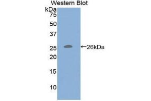 Western Blotting (WB) image for anti-CD79b Molecule, Immunoglobulin-Associated beta (CD79B) (AA 37-226) antibody (ABIN1859292) (CD79b Antikörper  (AA 37-226))