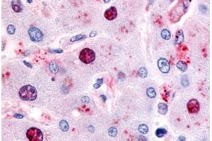 Immunohistochemistry (Paraffin-embedded Sections) (IHC (p)) image for anti-Nuclear Receptor Subfamily 5, Group A, Member 2 (NR5A2) (Internal Region) antibody (ABIN213385)