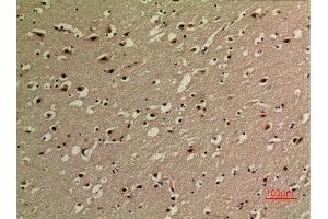Immunohistochemistry (IHC) analysis of paraffin-embedded Human Brain, antibody was diluted at 1:100. (NF-kB p65 Antikörper  (acLys314, acLys315))