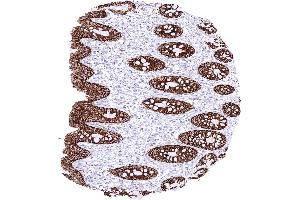 Rectum mucosa with a strong membranous CLDN3 staining of all epithelial cells (Rekombinanter Claudin 3 Antikörper  (Intracellular))