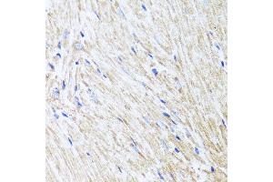 Immunohistochemistry of paraffin-embedded mouse heart using L2HGDH antibody at dilution of 1:100 (x40 lens). (L2HGDH Antikörper)