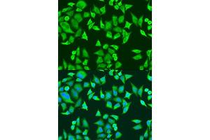 Immunofluorescence analysis of U2OS cells using SMN2 antibody (ABIN6127948, ABIN6148135, ABIN6148138 and ABIN6216175) at dilution of 1:100. (SMN2 Antikörper  (AA 1-197))