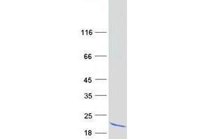 Western Blotting (WB) image for Ubiquitin-Conjugating Enzyme E2D 2 (UBE2D2) (Transcript Variant 2) protein (Myc-DYKDDDDK Tag) (ABIN2734796)