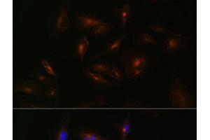 Immunofluorescence analysis of U-251 MG cells using ABCA2 Polyclonal Antibody at dilution of 1:100 (40x lens). (ABCA2 Antikörper)