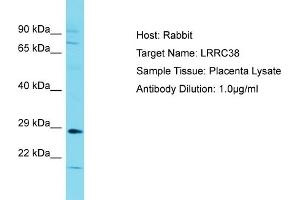 Host: Rabbit Target Name: LRRC38 Sample Type: Placenta lysates Antibody Dilution: 1. (LRRC38 Antikörper  (C-Term))