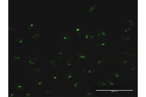 Immunofluorescence of purified MaxPab antibody to MAN1A2 on HeLa cell. (MAN1A2 Antikörper  (AA 1-641))