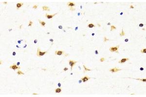 Immunohistochemistry (Paraffin-embedded Sections) (IHC (p)) image for anti-TIA1 Cytotoxic Granule-Associated RNA Binding Protein (TIA1) antibody (ABIN7262058)