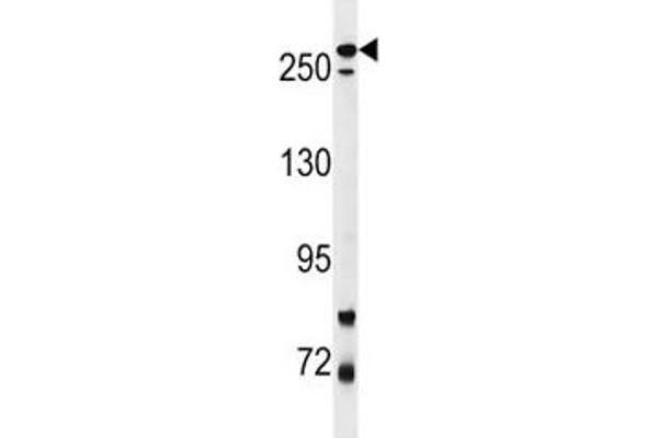 LRRK2 抗体  (AA 878-909)