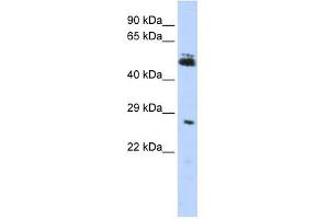 RNF212 antibody used at 1 ug/ml to detect target protein. (RNF212 Antikörper  (Middle Region))