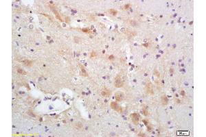 Formalin-fixed and paraffin embedded rat brain labeled with Rabbit Anti CYP5A1/Thromboxane synthase Polyclonal Antibody, Unconjugated (ABIN726065) at 1:200 followed by conjugation to the secondary antibody and DAB staining (PACAP-27/38 (AA 132-169) Antikörper)