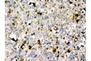 Anti-MyD88 antibody, IHC(P) IHC(P): Human Tonsil Tissue (MYD88 Antikörper  (Middle Region))