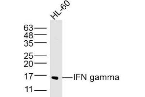 Image no. 4 for anti-Interferon gamma (IFNG) (AA 81-166) antibody (ABIN669141)