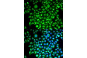 Immunofluorescence (IF) image for anti-Complement Factor I (CFI) antibody (ABIN1876824) (Complement Factor I Antikörper)