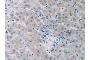 Figure. (SIRT4 Antikörper  (AA 28-314))