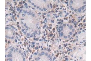 Detection of TGFb2 in Human Stomach Tissue using Polyclonal Antibody to Transforming Growth Factor Beta 2 (TGFb2) (TGFB2 Antikörper  (AA 303-414))