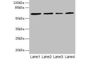 Western blot All lanes: CSGALNACT2 antibody at 4 μg/mL Lane 1: K562 whole cell lysate Lane 2: 293T whole cell lysate Lane 3: Jurkat whole cell lysate Lane 4: PC-3 whole cell lysate Secondary Goat polyclonal to rabbit IgG at 1/10000 dilution Predicted band size: 63, 39 kDa Observed band size: 63 kDa