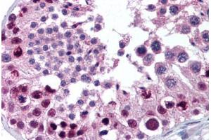 Human Testis (formalin-fixed, paraffin-embedded) stained with MTA2 antibody ABIN301765 at 10 ug/ml followed by biotinylated goat anti-rabbit IgG secondary antibody ABIN481713, alkaline phosphatase-streptavidin and chromogen. (MTA2 Antikörper  (AA 650-700))