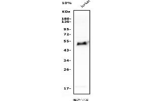 Western blot analysis of GATA3 using anti-GATA3 antibody (ABIN7603171).