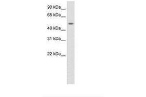 Image no. 1 for anti-DMRT-Like Family A1 (DMRTA1) (AA 131-180) antibody (ABIN6736143) (DMRTA1 Antikörper  (AA 131-180))