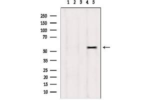 Western blot analysis of extracts from hepg2, using DPP4 antibody. (DPP4 Antikörper  (C-Term))