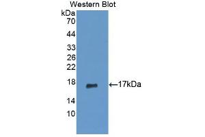 Western blot analysis of the recombinant protein. (PIP Antikörper  (AA 41-139))