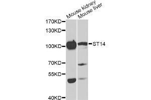 Western blot analysis of extracts of various cell lines, using ST14 antibody (ABIN6293606) at 1:1000 dilution.