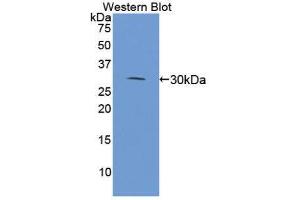 Western Blotting (WB) image for anti-Microtubule-Associated Protein 4 (MAP4) (AA 2-250) antibody (ABIN1869086)