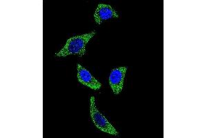 Confocal immunofluorescent analysis of TNFRSF1A Antibody (N-term) (ABIN655208 and ABIN2844822) with U-251MG cell followed by Alexa Fluor 488-conjugated goat anti-rabbit lgG (green). (TNFRSF1A Antikörper  (N-Term))