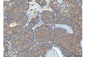 IHC analysis of RPL32 using anti-RPL32 antibody (ABIN7602916). (RPL32 Antikörper  (C-Term))
