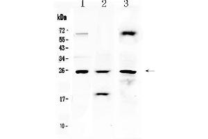 Western blot analysis of TIMP4 using anti- TIMP4 antibody . (TIMP4 Antikörper  (AA 174-224))