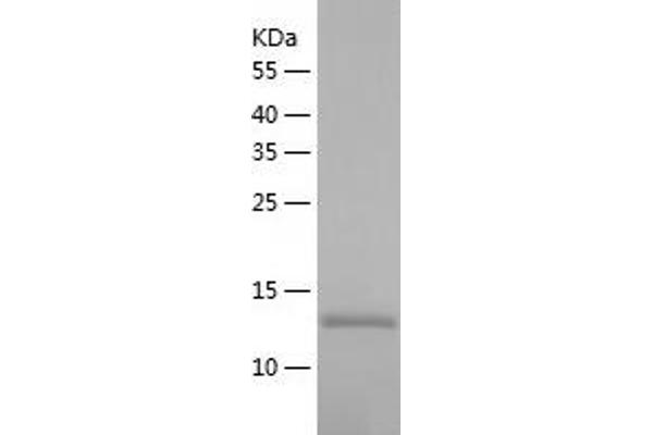 CTCF Protein (AA 1-154) (His tag)