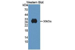 Western blot analysis of the recombinant protein. (Retbindin Antikörper  (AA 32-247))