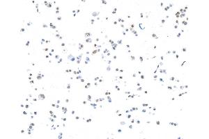 Immunocytochemistry (ICC) image for anti-CCCTC-Binding Factor (Zinc Finger Protein) (CTCF) (AA 650-700) antibody (ABIN7453967) (Rekombinanter CTCF Antikörper  (AA 650-700))