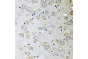 Immunohistochemistry of paraffin-embedded mouse brain using ATAD3A antibody. (ATAD3A Antikörper)
