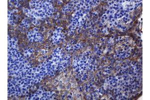 Image no. 2 for anti-Cadherin 1, Type 1, E-Cadherin (Epithelial) (CDH1) antibody (ABIN1497941) (E-cadherin Antikörper)